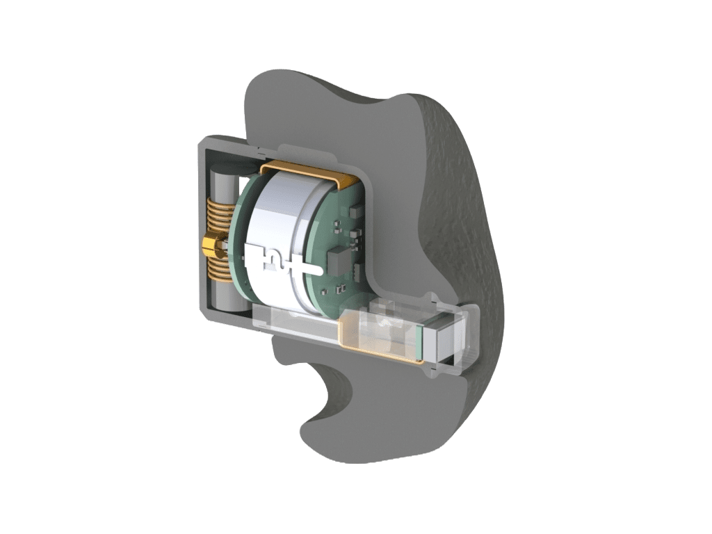 Cross-section view of a cochlear implant, showing internal components including the receiver-stimulator and electrode array, encased in a gray housing.
